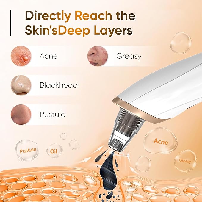 Rechargeable 6-in-1 blackhead remover facial device by Tarjah Mart with multiple attachments for skin cleansing and pore extraction.