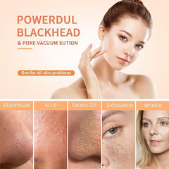 Rechargeable 6-in-1 facial blackhead remover tool from Tarjah Mart showing multiple attachments for pore cleansing and skin care.