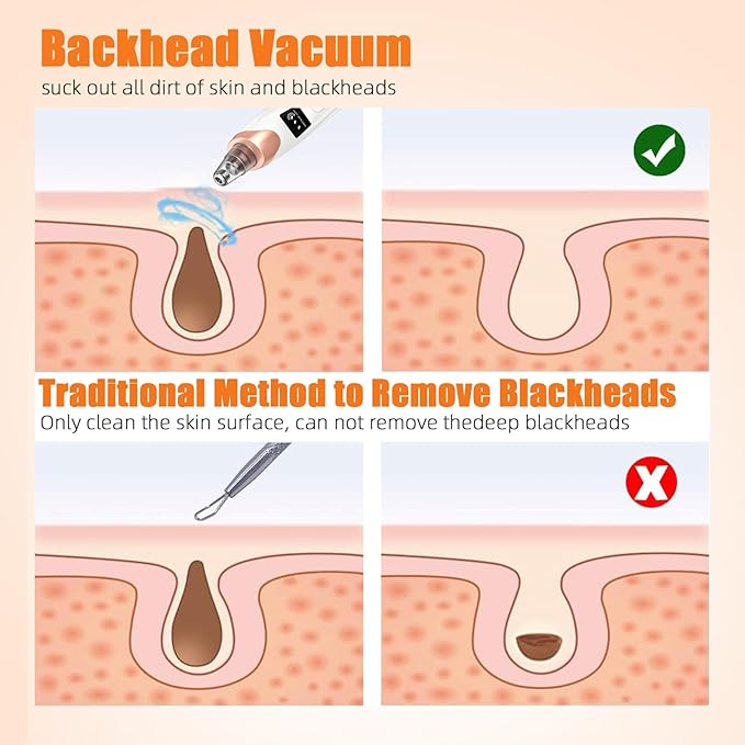 Blackhead remover 6-in-1 rechargeable facial device by Tarjah Mart with different attachments for deep pore cleaning and skin smoothing.