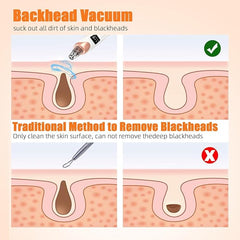 Blackhead remover 6-in-1 rechargeable facial device by Tarjah Mart with different attachments for deep pore cleaning and skin smoothing.